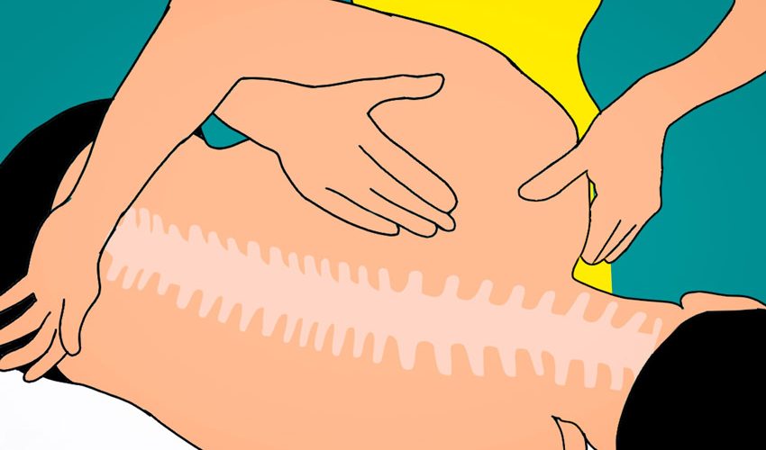 יש מעסה בקהל